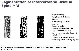 a representative slide from Semra's presentation